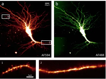 Figure 1. Example light sheet images of a large, living pyramidal neuron. These images were acquired from the CA3 region of an organotypic rat hippocampal slice, using the prototype light sheet fluorescence microscope described