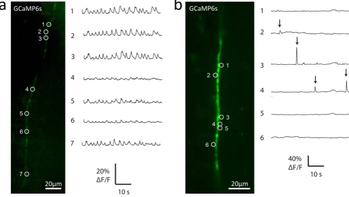 Figure 3. fluorescence (%shows an example single-plane image of an axon, acquired on the prototype LSFM using 488 nm illumination