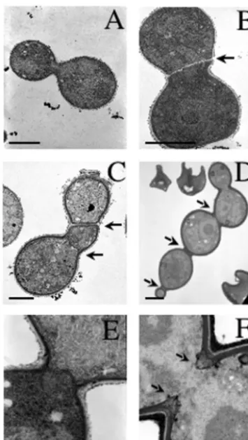 FIG. 7. Defective septal positioning and formation in cts1cts1cts1YPD and ﬁxed in osmium tetroxide