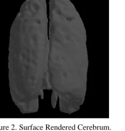 Figure 3. Combined Surface Rendered Model of Liver