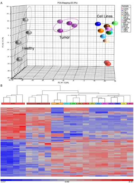 Figure 1. Differential microRNA expressed in cervical cancer cells. A. Principal Component Analysis (PCA) of microR-NAs (gray balls: healthy cervical tissues; purple balls: tumor cervical tissues; the remaining balls represent each cer-vical cancer cell li