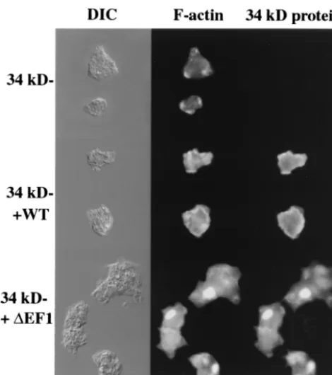 FIG. 4. Hirano bodies in 34-kDa �were localized in 34-kDa protein-null cells and in 34-kDa protein-nullcells expressing recombinant 34-kDa and 34-kDaobserved by ﬂuorescence microscopy
