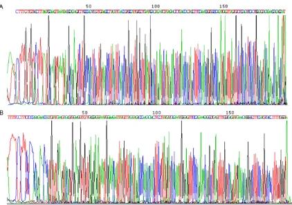 Figure 5. Representative sequences of C-Kit genetic mutation analysis. No mutations were detected by sequencing using (A) exon 9 primers or (B) exon 11 primers.
