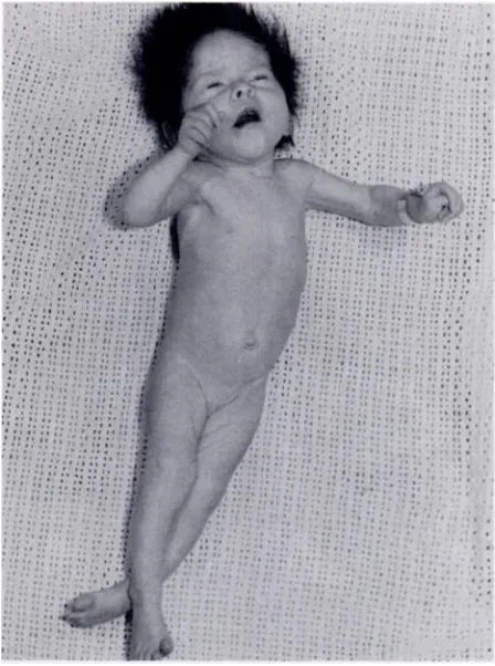 Fig.1)