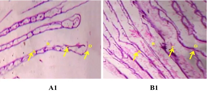 Fig 1A: Histopathology Studies of Chana Punctatus in Gill samples treated at 96 hrs (A&B); A1: Control: B1 Treated: In Control, A.Central Axis
