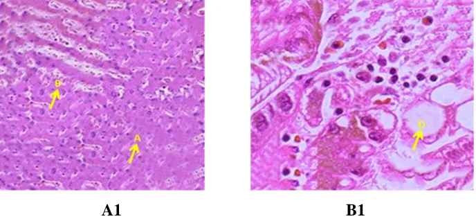 Figure 2 A: Histopathology Studies of Channa Punctatus in Liver samples treated at 96 hrs (A1 &B1)