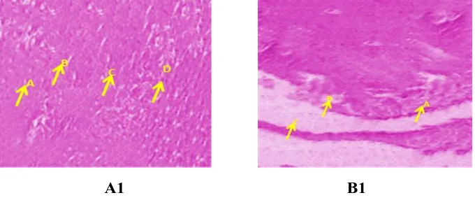 Figure 3 A: Histopathology Studies of Channa Punctatus in Brain samples treated at 96 hrs (A1 & B1); A1 Control: B1Treated: In Control, A Dorsal olfactory area