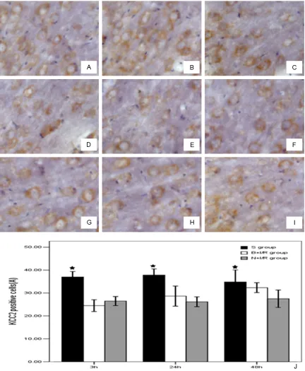 Figure 5. Bumetanide does not change the KCC2 protein expression level in rat brain cortex