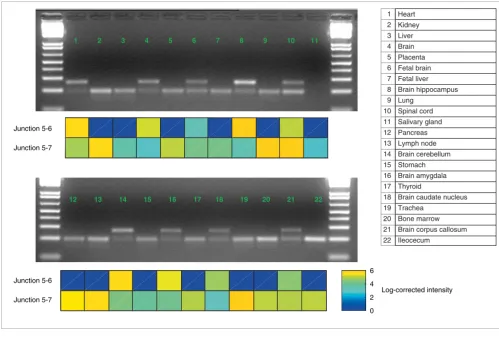 Figure 11Annexin A7 RT-PCR experiments