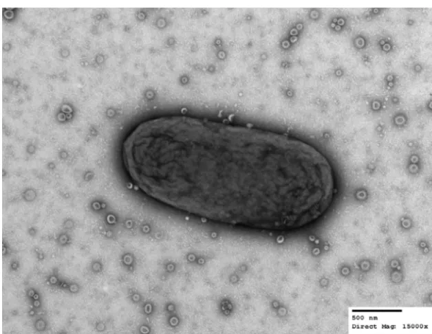 FIG 1 B. thetaiotaomicronof a singlecells were swabbed from a solid-medium plate, suspended in PBS, and processed for TEM