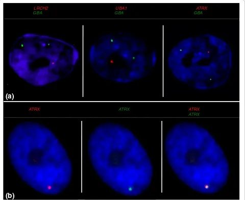 Figure 3 Transcriptional activity of an X-borne gene and autosomal control in male fibroblasts