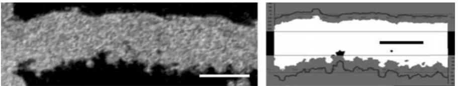 Figure 4. An XCT image used in the measurement of surface texture parameters, with a binarised version of the slice and the extracted profiles