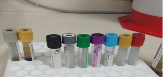 Figure 1: Blood collection tubes 