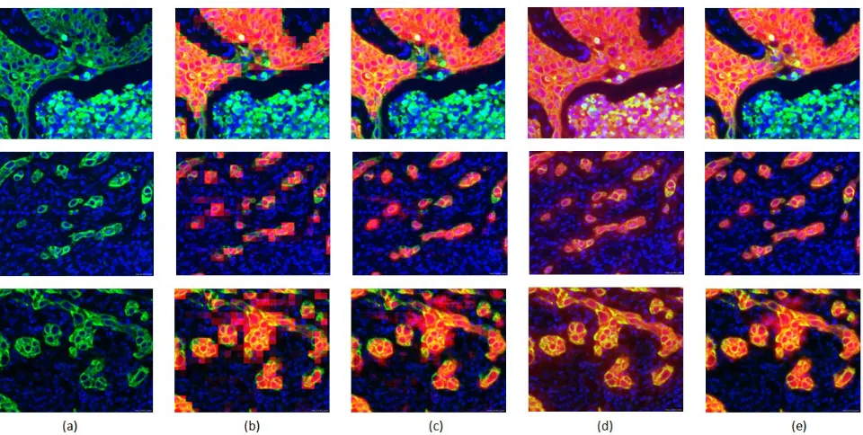 Figure 4. (a) CK and Hoechst channels; (b)-(c) Overlaid coarse CNN heatmaps for prediction strides of 16 and 4 pixelsrespectively; (d) Pixelwise heatmaps produced by the visual context RF model if only the IF channels are taken as inputfor the computation of the visual context features; (e) and if the linearly interpolated CNN maps are additionally taken.