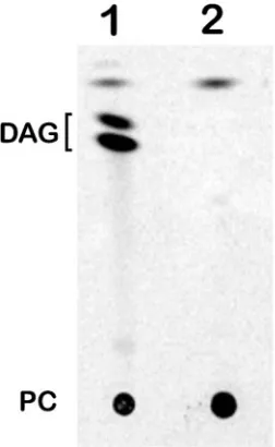 FIG. 5. (A) Western blot assays showing the lack of reactivity ofpatient sera with the deglycosylated forms of phytase (lanes 2) and
