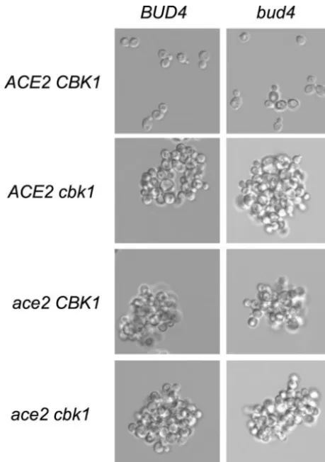 FIG. 2. Clumpy morphology of ace2grown in liquid YEPD medium and examined microscopically usingNomarski optics