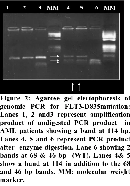 Figure 2: Agarose gel electophoresis of  genomic PCR for FLT3-D835mutation: 