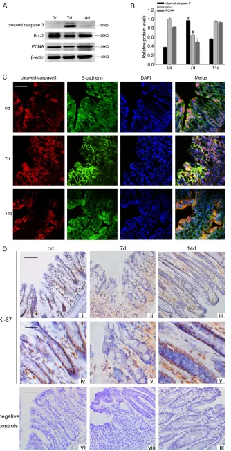 Figure 2. (A) Signifi< 0.05,). (C) Double immunofluorescent analy-sis showed that en-hanced of cleaved-caspase 3 with observed administration