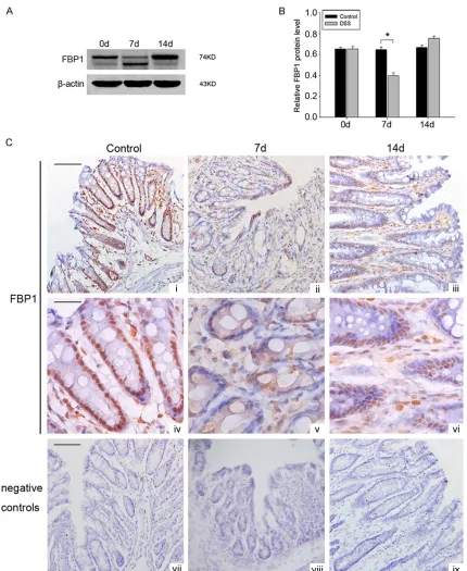 Figure 3. Changes of FBP1 expression in colonic tissues during mice experimental colitis