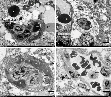 Figure 5. Fine morphological structure of white blood cells (WBCs) accumulation in cerebral microvessel