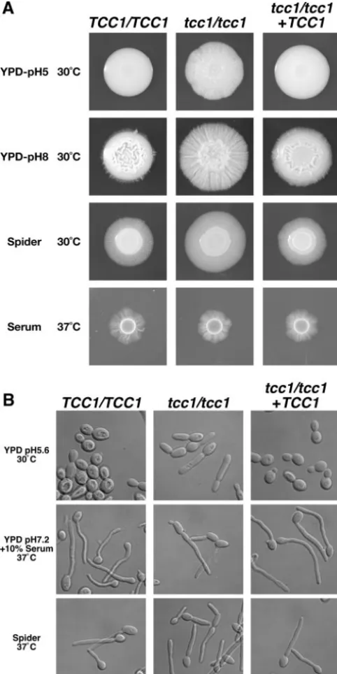 FIG. 5. Morphology ofTCC107 (indicated at the left. Bar, 10indicated agar plate and grown for 7 days at 30°C on YPD medium andSpider medium and at 37°C on agar medium containing 10% serum.(B) Cells from strains TUA6 (dium (A) and in liquid medium (B)