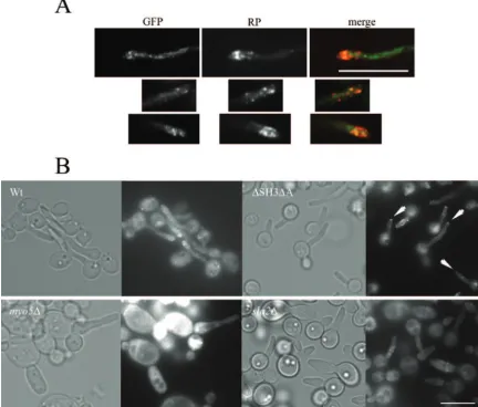 FIG. 4. Rvs167-GFP does not localize in a polarized manner in the myo5cortical actin patches in wild-type hyphal tips