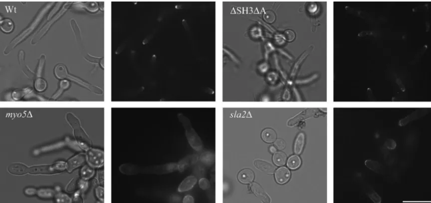 FIG. 7. Depolarized localization of GFP-Gsc1p in cell walls of myo5inducing conditions expressing GFP-Gsc1p were visualized by epiﬂuorescence microscopy