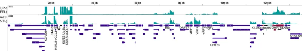 FIG 3 KSHV exhibits an expression proﬁle consistent with latent infection in one AITL sample (PAT3)