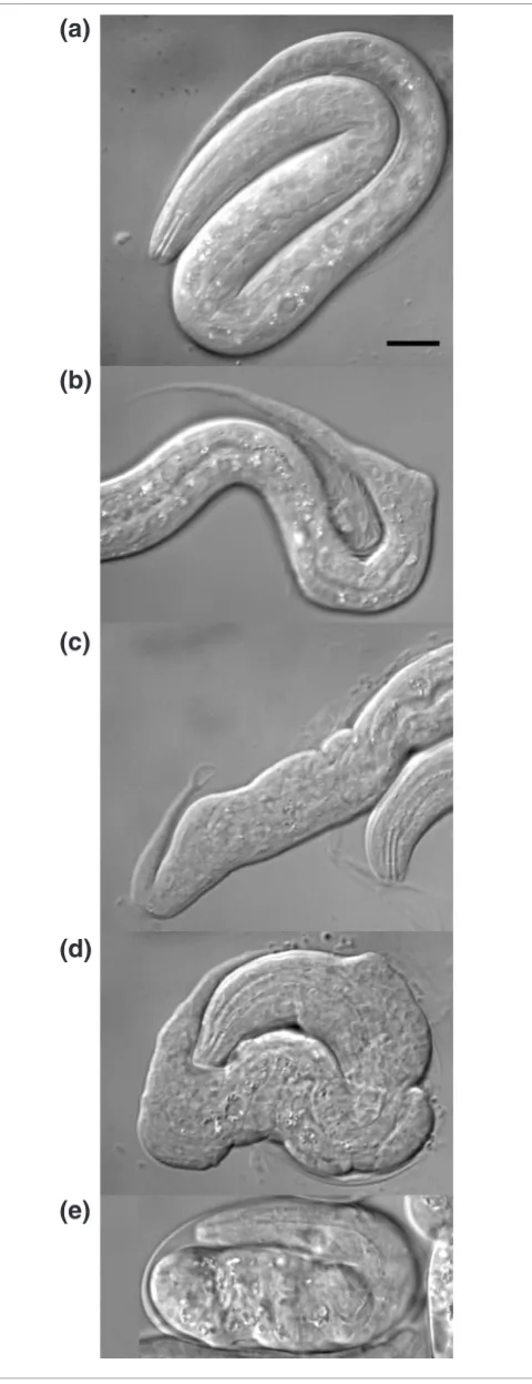 Figure 2tbx-8 8(ok656); tbx-9(RNAi)phenotype, with (b) and (c) providing examples of the posterior morphological defects observed at low frequency after disruption of or high frequency after disruption of both individual that has hatched but will arrest as