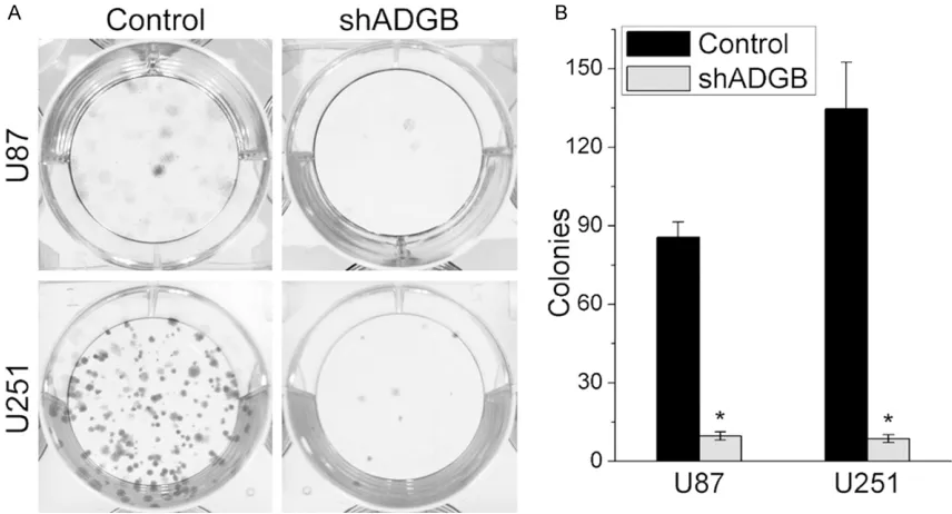 Figure 2. ADGB Knockdown inhibits the growth of glioma cell lines U251, U87, and U373