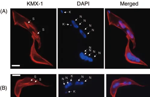 FIG. 6. Mitotic spindle labeling in TbPLK-depleted cells. Cells 2 days into RNAi were ﬁxed with 3.7% formaldehyde and labeled with KMX-1and DAPI