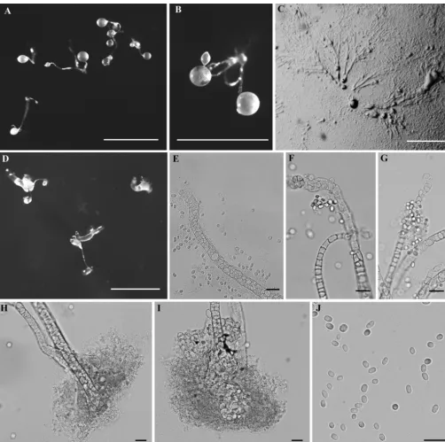 FIG 3Morphological features ofSorophore bases. (J) Spores. Bars: A to D, 1 mm; E to J, 20 Dictyostelium barbarae