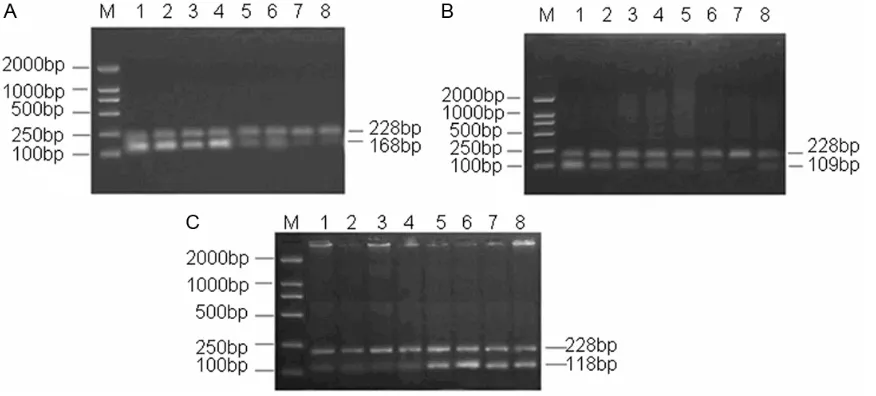 Figure 1. The expression of BMPR1α, ACTN4α and FABP7 genes mRNA by RT-PCR. A: BMPR1α gene, M was Marker DL 2000, lanes 1, 2, 3 and 4 were stenotic colon segment, lanes 5, 6, 7 and 8 were normal segment