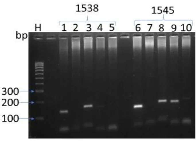 Figure 3.8. Agarose gel electrophoresis of RT-PCR products of tissue samples 1538 & 