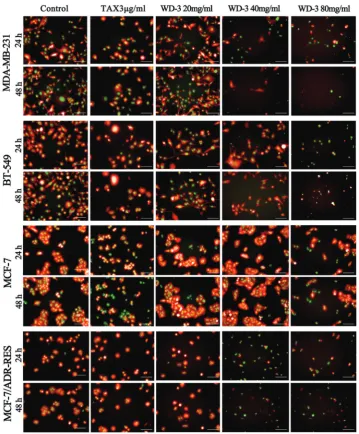 FIGURE 4. Fluorescence imaging of four breast cancer cell lines treated withWD-3 at different time points and concentrations