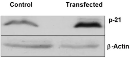 TABLE 2. IC50 values (in µM) and increase folds in the sensitivity to gemcitabine of each cell line transfected with either empty 
