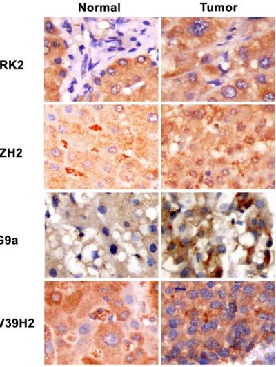 Figure 2. Tissue microarray-based immunohistochemical staining patterns of four histone-modifying proteins
