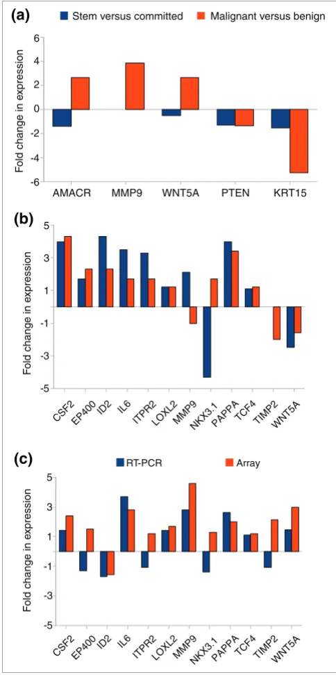 Figure 2Nested RT-PCR for the detection of the TMPRSS2:ERG fusion