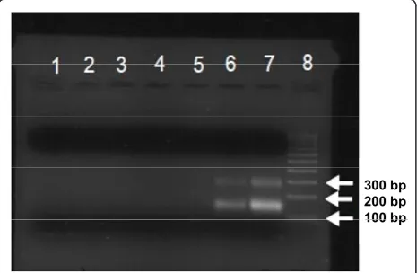 Table 4 Positive predictive value (PPV) and negative predictive value (NPV) for assessing the prognostic utility of theaverage cfDNA, average MODS, and average protein C