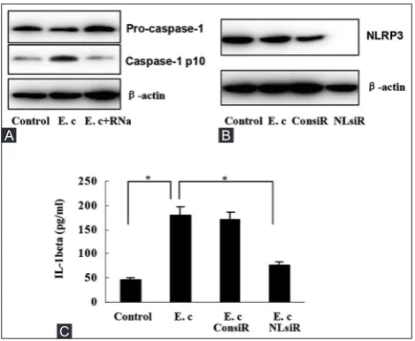 FIGURE 1. Interleukin-1 beta (IL-1β) induction by Escherichia coli RNA, (A) E. coli RNA stimulated IL-1β secretion by hepatic stellate cells (HSC)-T6 cells, which was abrogated upon RNase A digestion, (B) IL-1β expression was elevated, whereas pro-IL-1β ex