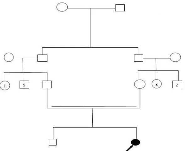 Fig. 1:  Pedigree and sequencing chromatograph of the studied family. Filled circle represents an affected individual