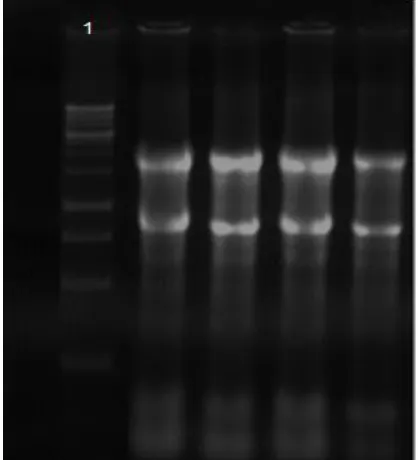 Table 5: Haplotype frequencies estimation (n=100)