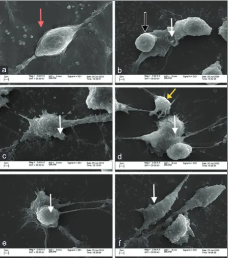 FIGURE 6. Scanning electron micrographs. (a) Scanning electron micrograph of control/untreated astrocyte showing retraction ﬁ bers (red arrow)