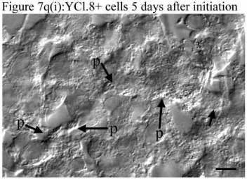 Figure 7q(i):YCl.8+ cells 5 days after initiationThis DIC image shows the long processes which arefound along the tops and between YCl.8+ cells