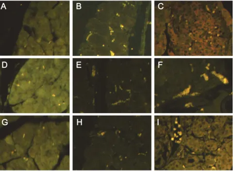 FIGURE 1.  Pathological examination of pancreas (HE staining, ×20). A: control group; B: AP group (12 h); C: IFN group (12 h).