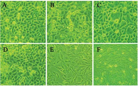TABLE 7.  Eff ect of pcDNA3.1 transfection on proliferation of BGC823 cells, SGC7901 cells and GES-1 cells