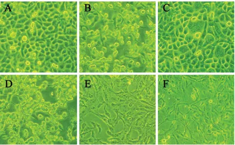 TABLE 8.  Changes in cell cycle and apoptosis rate of BGC823 cells at 48 h after TFF1-pcDNA3.1 transfection (%)