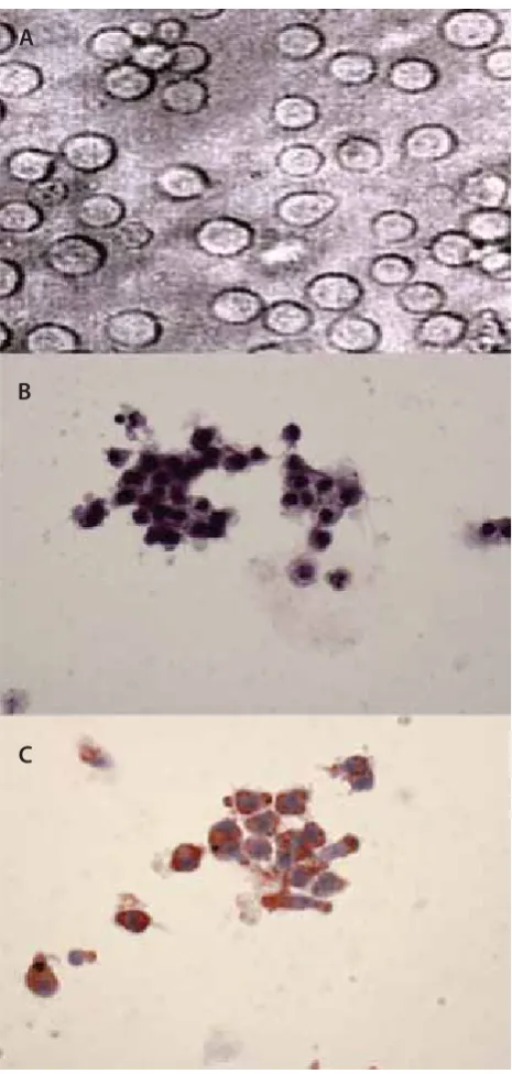 FIGURE 1.  PMA and ox-LDL induced the diff erentiation of U937 cells into foam cells. (A)