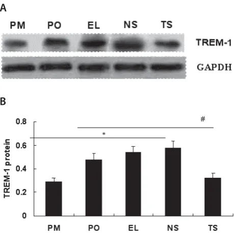 FIGURE 5.  TREM-1 knockdown suppressed TNF-α and IL-8 pro-duction in U937 foam cells. After PMA-induced U937 cells were transfected with TREM-1 siRNA (TS), negative siRNA (NS) or empty liposome (EL), and then treated with ox-LDL, the levels of TNF-α (A) an