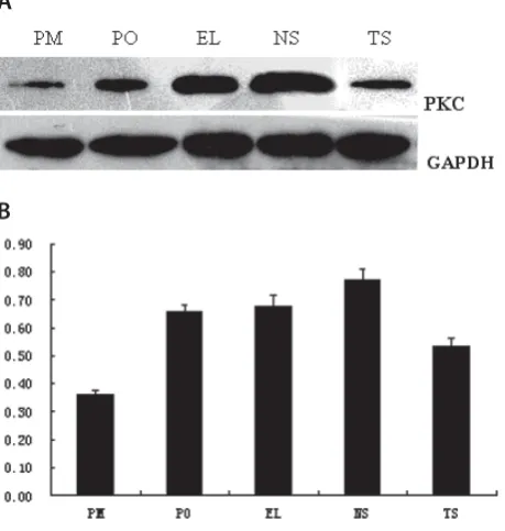 FIGURE 6.  TREM-1 knockdown suppressed ox-LDL-induced showing the expression of TREM-1 and GAPDH proteins in U937 cells; (B)